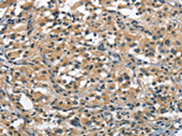 ACPT Antibody PACO18646