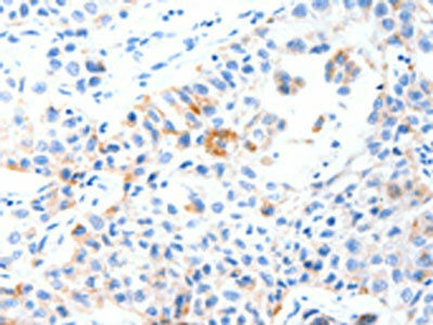 MUC3A Antibody PACO18715