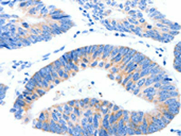 MUC3A Antibody PACO18715