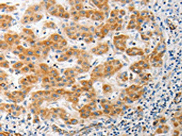 MUC13 Antibody PACO18718