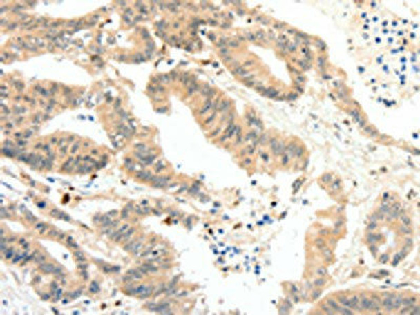 RRAD Antibody PACO18860