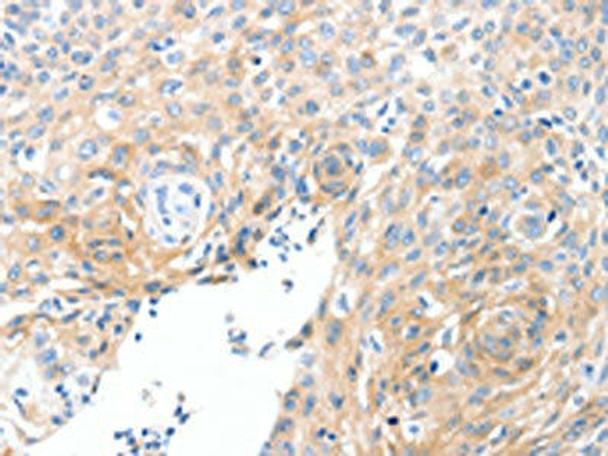 SLC22A17 Antibody PACO18897