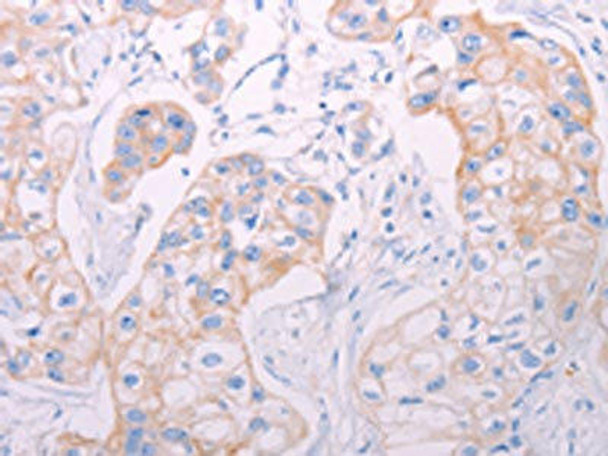 ADAMTS14 Antibody PACO19058