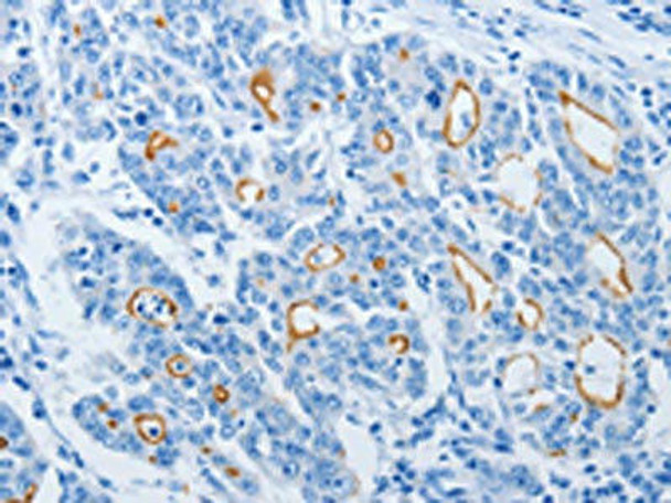 NEK10 Antibody PACO19211