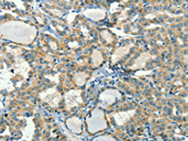 CALCA Antibody PACO19217