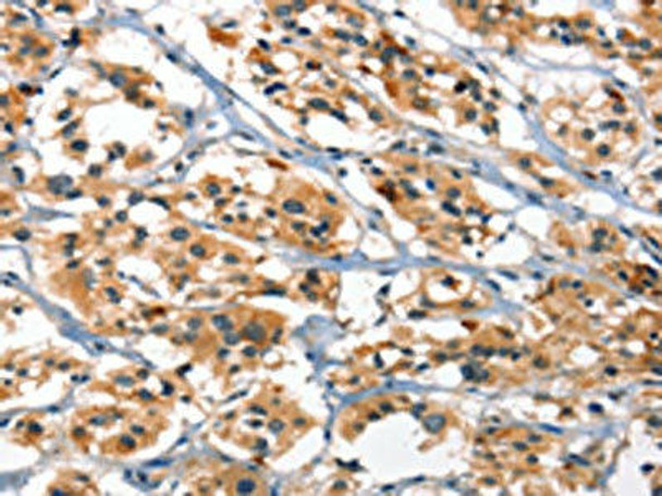 DEFA1/DEFA3 Antibody PACO19275