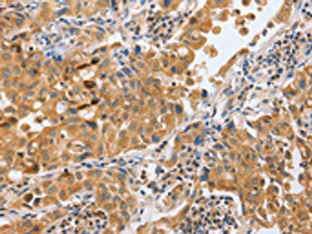 BLNK Antibody PACO19352