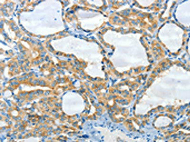 CNTNAP3 Antibody PACO19500