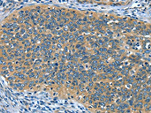 DTX1 Antibody PACO19561