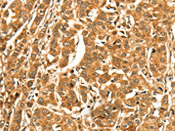 DIRAS1 Antibody PACO19575