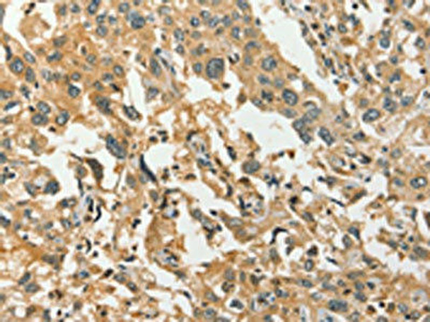 DIRAS1 Antibody PACO19576