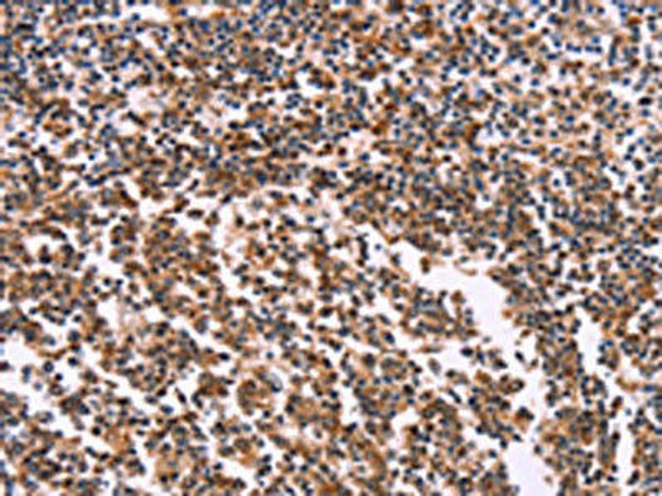 MSMO1 Antibody PACO19615