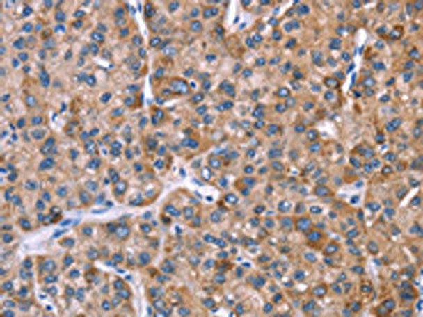 EVC2 Antibody PACO19628