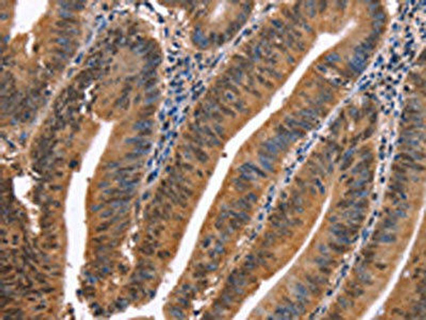 EVC2 Antibody PACO19629