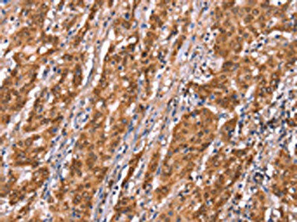 FAM13B Antibody PACO19643