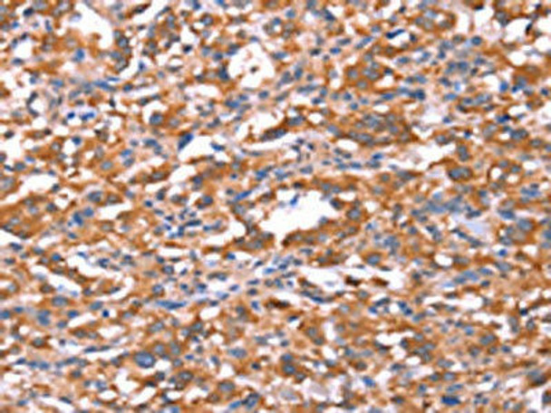 FAM13B Antibody PACO19644