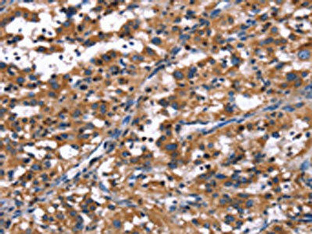 R3HCC1L Antibody PACO19704