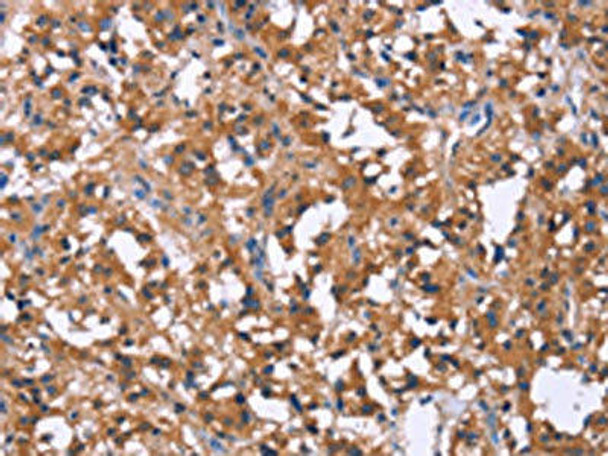 SLC52A1 Antibody PACO19736
