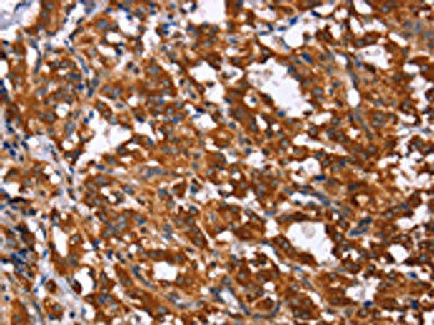 GPR65 Antibody PACO19739