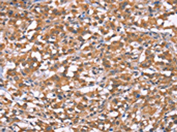 HRASLS2 Antibody PACO19781