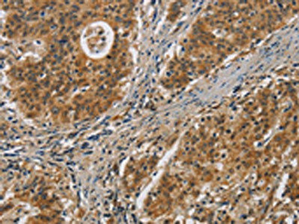 IL17D Antibody PACO19822