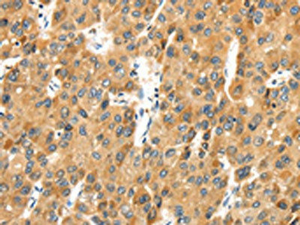 MACC1 Antibody PACO19963