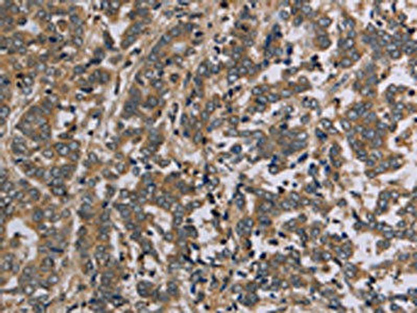 AATK Antibody PACO20090