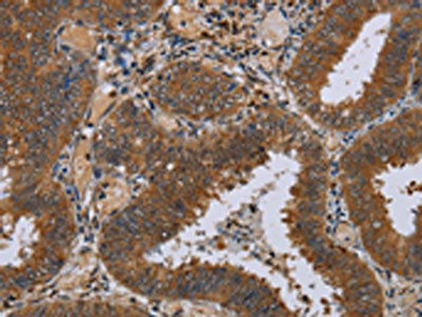 NPTX1 Antibody PACO20123