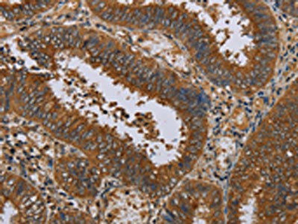 NPTX1 Antibody PACO20124