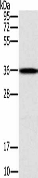 CENPV Antibody PACO20280