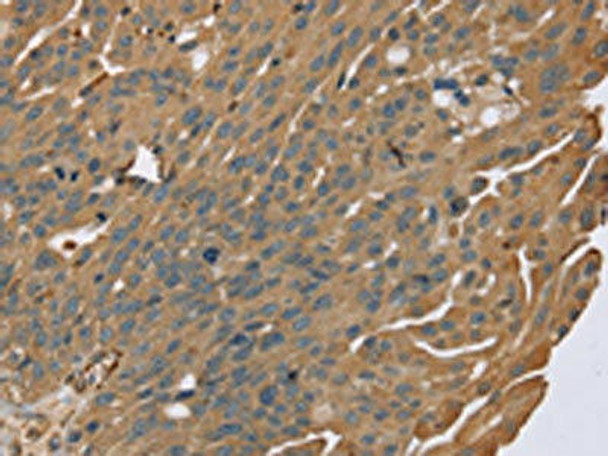 ZMIZ1 Antibody PACO20335