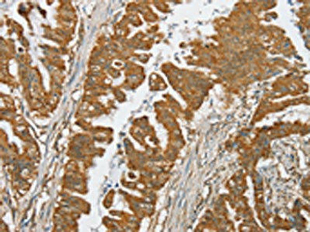 SERINC2 Antibody PACO20437