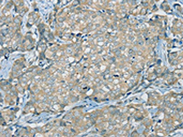 SERPINA11 Antibody PACO20444