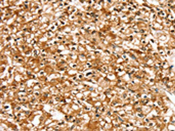 SLC16A12 Antibody PACO20481