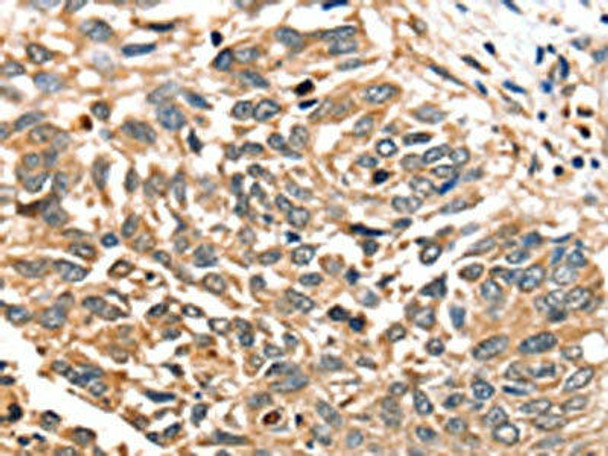 SLC16A12 Antibody PACO20482