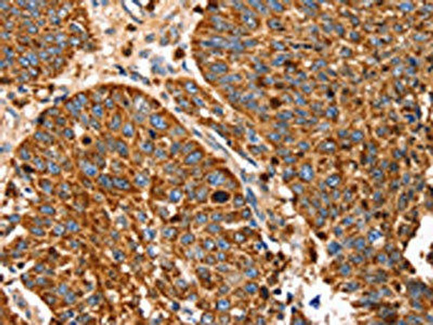 SLC27A5 Antibody PACO20499