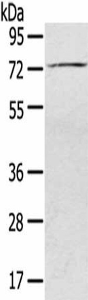 SLC27A5 Antibody PACO20500