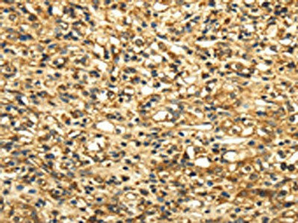 SLC6A19 Antibody PACO20525