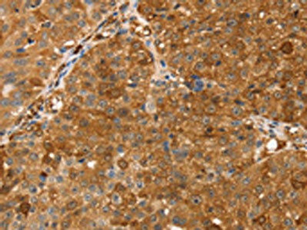 TMSB10 Antibody PACO20642