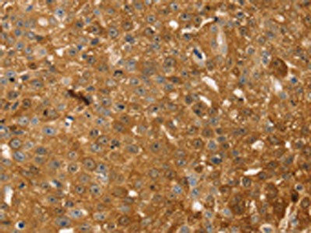 TMSB10 Antibody PACO20643