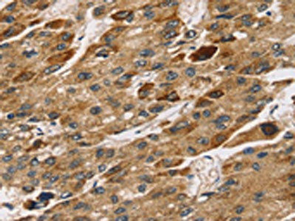 TM4SF1 Antibody PACO20646