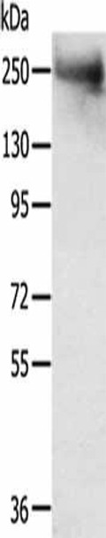 TACC2 Antibody PACO20648