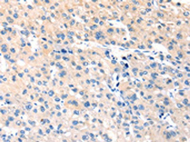 TCERG1L Antibody PACO20668