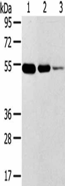 TMPRSS11F Antibody PACO20716