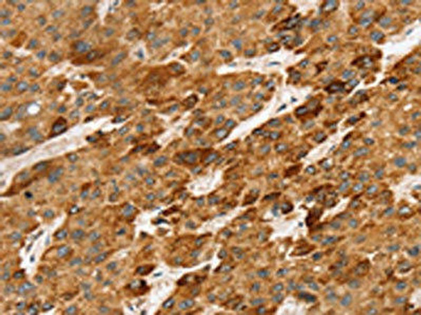 LTB Antibody PACO20722