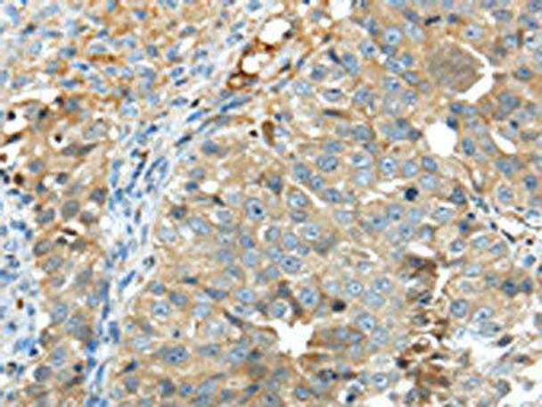 TNIP1 Antibody PACO20729