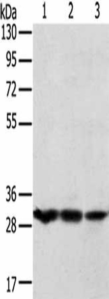 TPD52L2 Antibody PACO20739