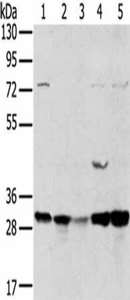TPD52L2 Antibody PACO20740