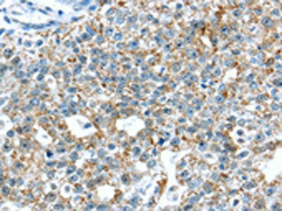 TTBK1 Antibody PACO20783