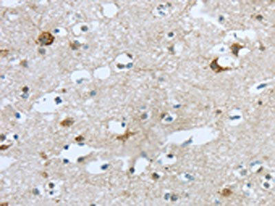 TTBK1 Antibody PACO20783